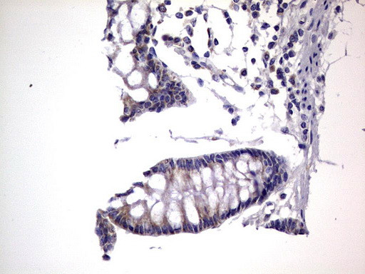 PRRX1 Antibody in Immunohistochemistry (Paraffin) (IHC (P))