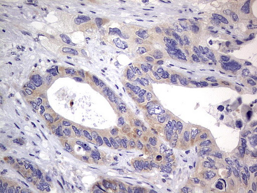 PRRX1 Antibody in Immunohistochemistry (Paraffin) (IHC (P))