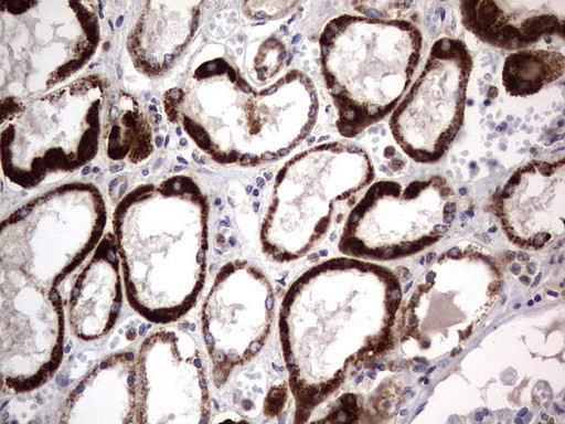 PRRX1 Antibody in Immunohistochemistry (Paraffin) (IHC (P))