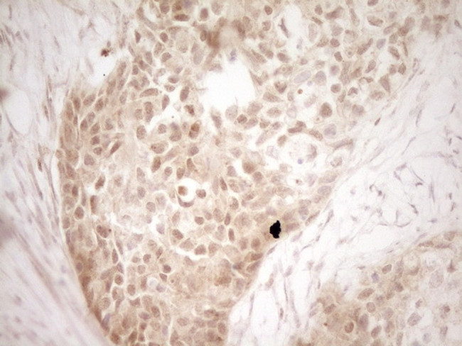 PRTN3 Antibody in Immunohistochemistry (Paraffin) (IHC (P))