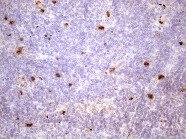 PRTN3 Antibody in Immunohistochemistry (Paraffin) (IHC (P))