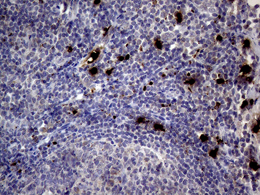 PRTN3 Antibody in Immunohistochemistry (Paraffin) (IHC (P))