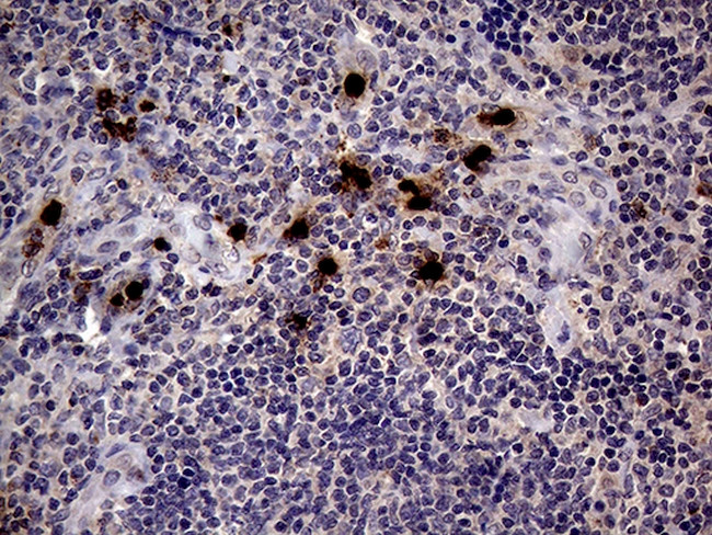 PRTN3 Antibody in Immunohistochemistry (Paraffin) (IHC (P))