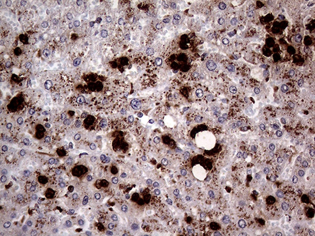 PRTN3 Antibody in Immunohistochemistry (Paraffin) (IHC (P))