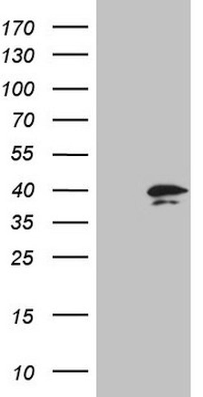 PRTN3 Antibody in Western Blot (WB)