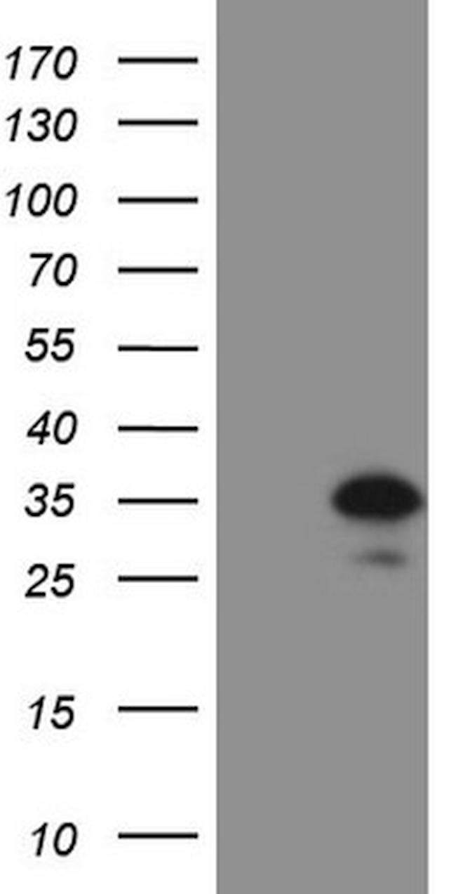 PRTN3 Antibody in Western Blot (WB)