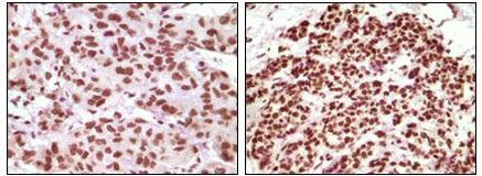 Progesterone Receptor Antibody in Immunohistochemistry (Paraffin) (IHC (P))