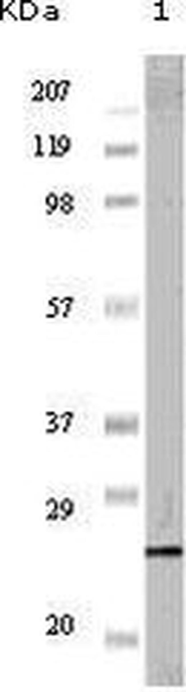 Progesterone Receptor Antibody in Western Blot (WB)