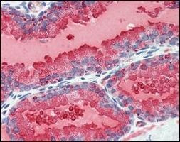 PSA Antibody in Immunohistochemistry (Paraffin) (IHC (P))