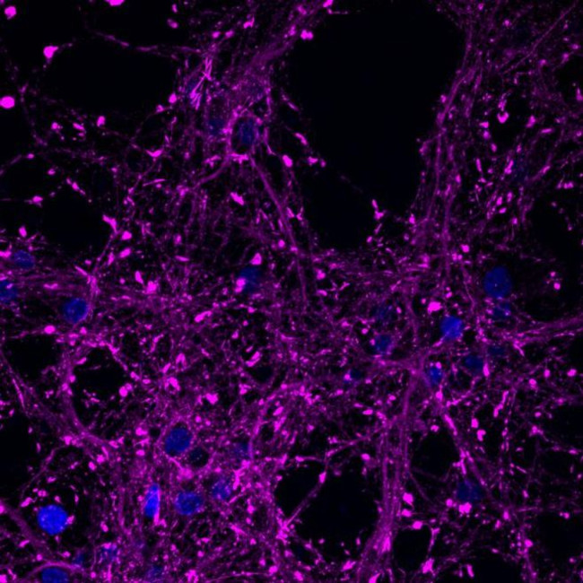 PSD-95 Antibody in Immunocytochemistry (ICC/IF)