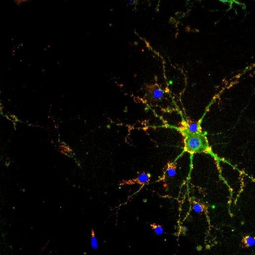 PSD-95 Antibody in Immunocytochemistry (ICC/IF)