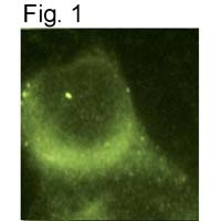 Presenilin 1 Antibody in Immunocytochemistry (ICC/IF)