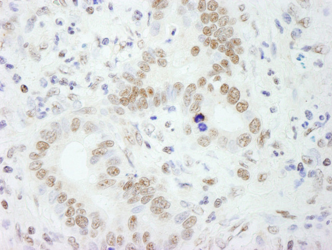 PSF/SFPQ Antibody in Immunohistochemistry (IHC)