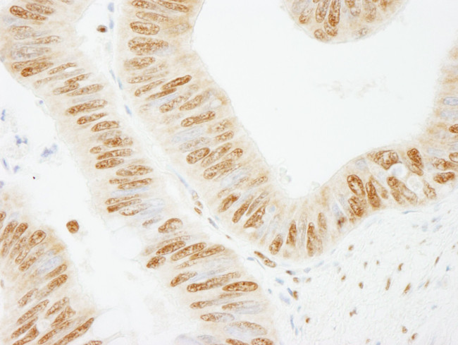 PSF/SFPQ Antibody in Immunohistochemistry (IHC)