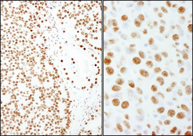 PSF/SFPQ Antibody in Immunohistochemistry (IHC)