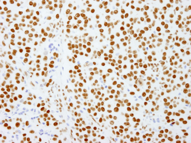 PSF/SFPQ Antibody in Immunohistochemistry (IHC)