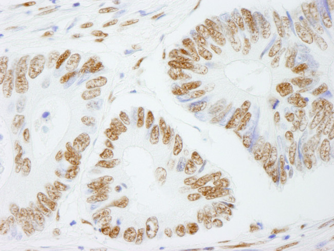 PSF/SFPQ Antibody in Immunohistochemistry (IHC)