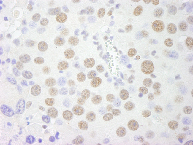 PSF/SFPQ Antibody in Immunohistochemistry (IHC)