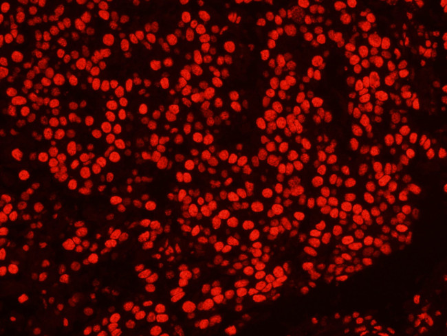 PSF/SFPQ Antibody in Immunohistochemistry (IHC)