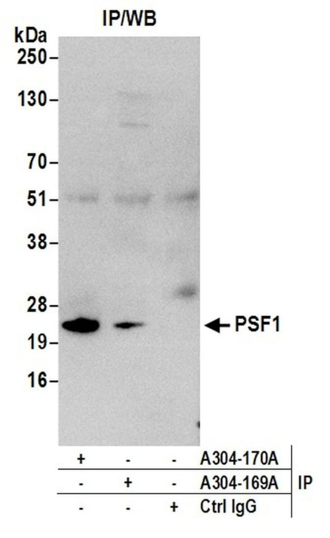 PSF1 Antibody in Immunoprecipitation (IP)