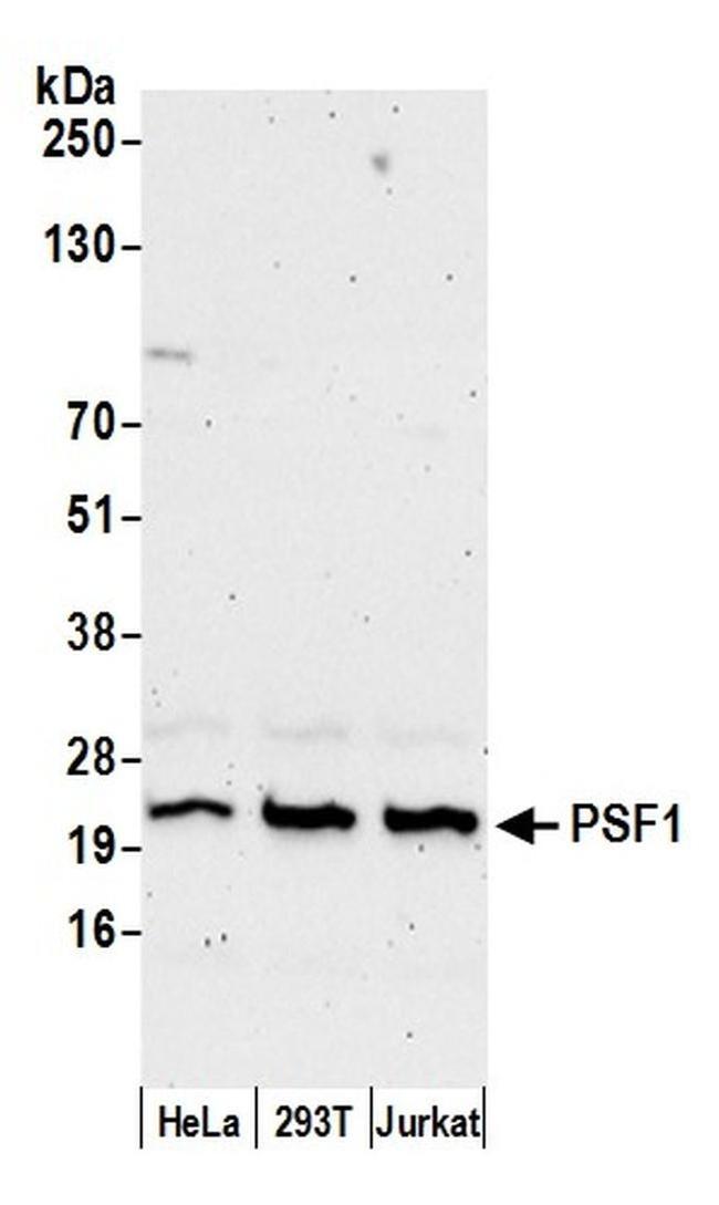 PSF1 Antibody in Western Blot (WB)