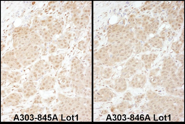 PSMA1 Antibody in Immunohistochemistry (IHC)