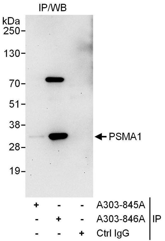 PSMA1 Antibody in Western Blot (WB)