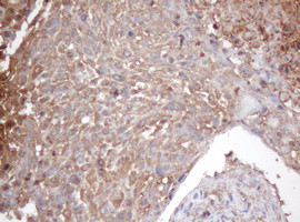 PSMA2 Antibody in Immunohistochemistry (Paraffin) (IHC (P))