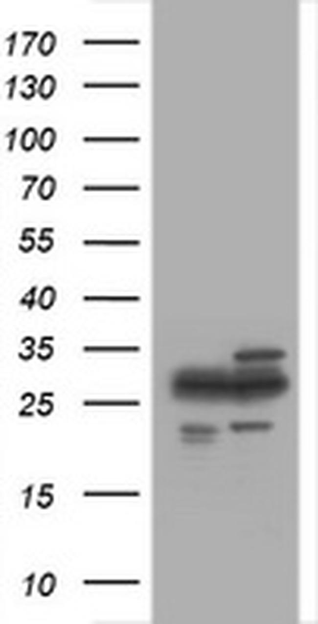 PSMA2 Antibody in Western Blot (WB)