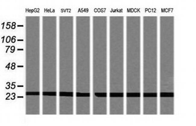 PSMA2 Antibody in Western Blot (WB)