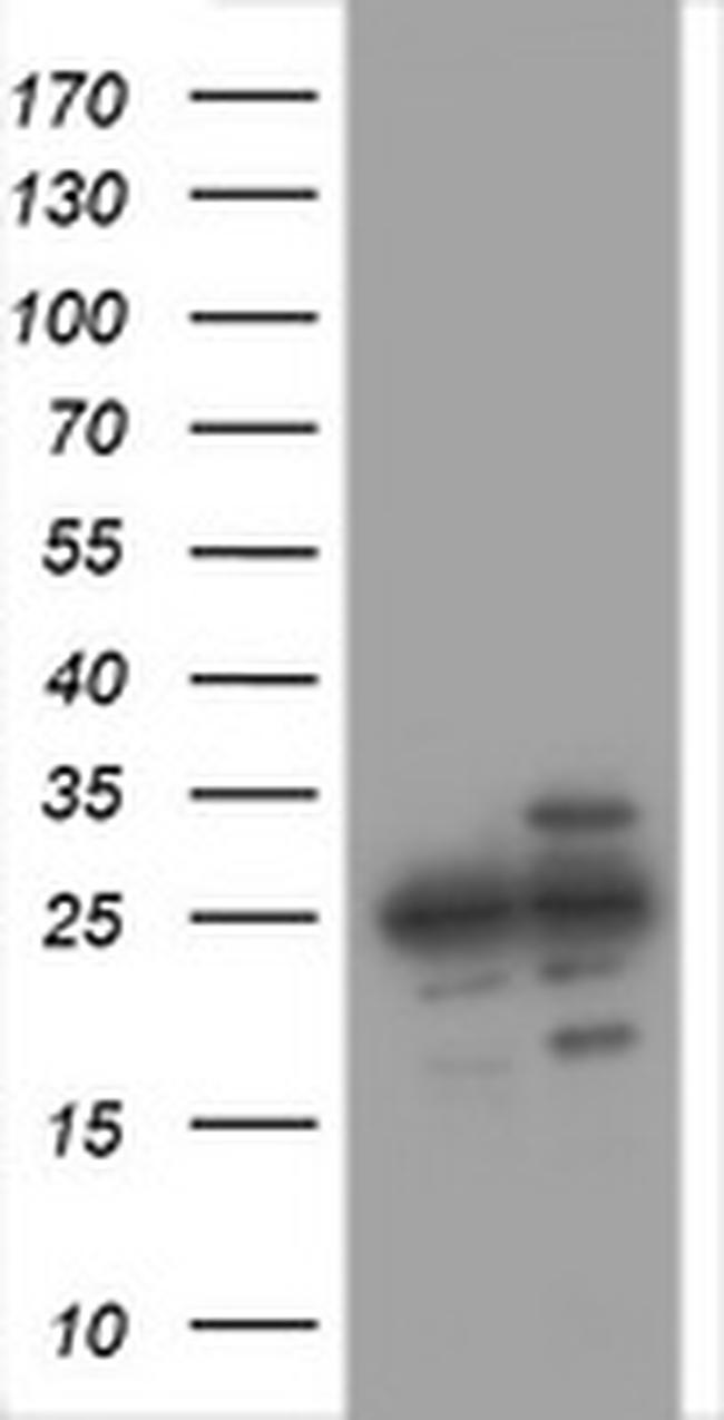 PSMA2 Antibody in Western Blot (WB)