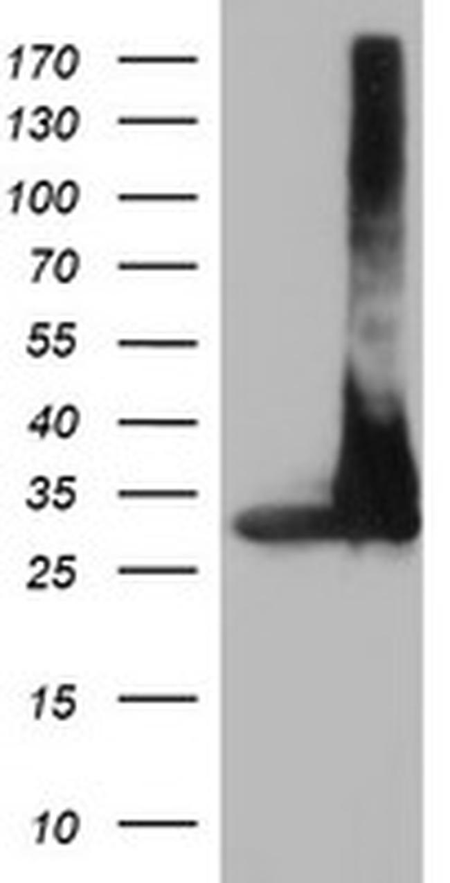 PSMA4 Antibody in Western Blot (WB)