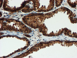 PSMA6 Antibody in Immunohistochemistry (Paraffin) (IHC (P))