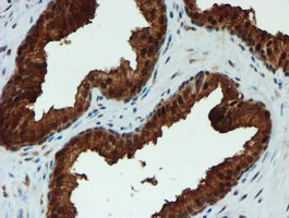 PSMA6 Antibody in Immunohistochemistry (Paraffin) (IHC (P))