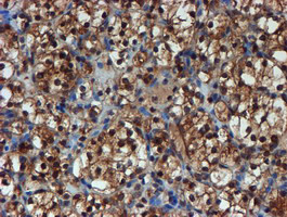 PSMA6 Antibody in Immunohistochemistry (Paraffin) (IHC (P))