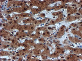 PSMA6 Antibody in Immunohistochemistry (Paraffin) (IHC (P))