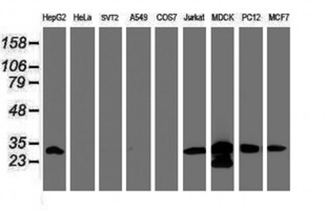 PSMA6 Antibody in Western Blot (WB)