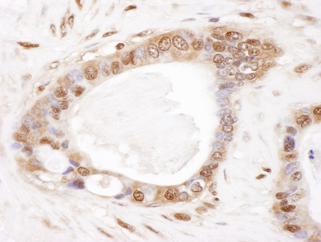 PSMB2 Antibody in Immunohistochemistry (IHC)