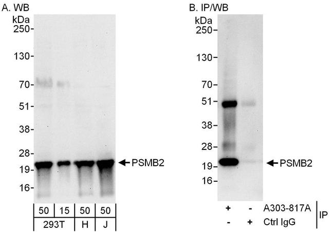 PSMB2 Antibody in Western Blot (WB)