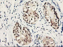 PSMB4 Antibody in Immunohistochemistry (Paraffin) (IHC (P))