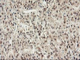 PSMB4 Antibody in Immunohistochemistry (Paraffin) (IHC (P))