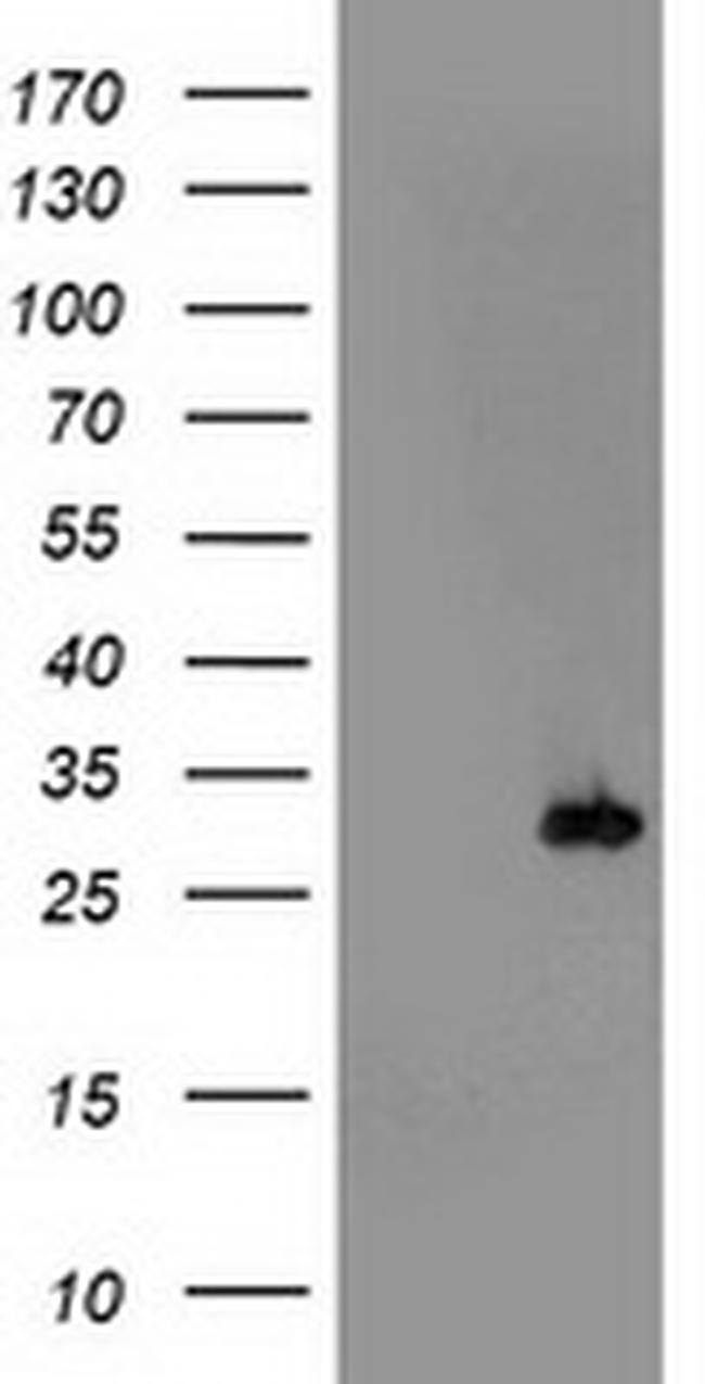 PSMB4 Antibody in Western Blot (WB)