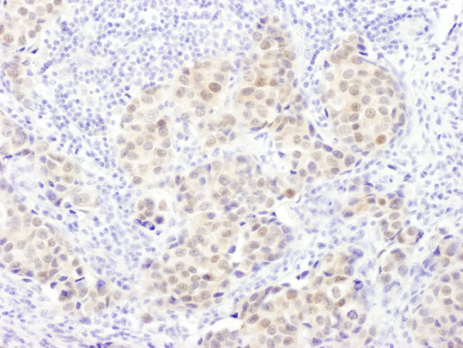 PSMB5 Antibody in Immunohistochemistry (IHC)