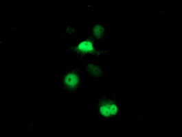 PSMB7 Antibody in Immunocytochemistry (ICC/IF)