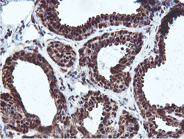 PSMB7 Antibody in Immunohistochemistry (Paraffin) (IHC (P))