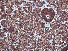 PSMB7 Antibody in Immunohistochemistry (Paraffin) (IHC (P))