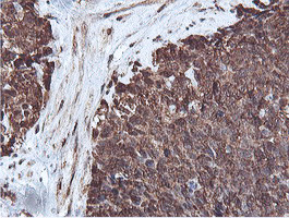 PSMB7 Antibody in Immunohistochemistry (Paraffin) (IHC (P))