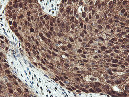 PSMB7 Antibody in Immunohistochemistry (Paraffin) (IHC (P))