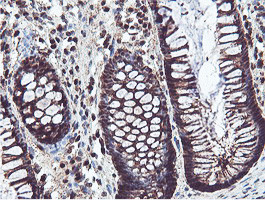 PSMB7 Antibody in Immunohistochemistry (Paraffin) (IHC (P))