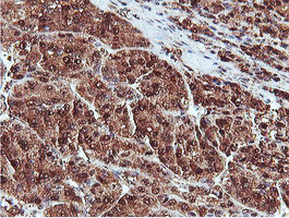 PSMB7 Antibody in Immunohistochemistry (Paraffin) (IHC (P))